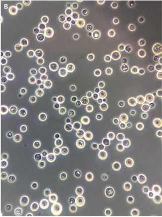 Negative staining yeasts